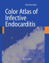 Omslagafbeelding: Color Atlas of Infective Endocarditis 9781852339371