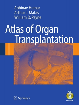 Cover image: Atlas of Organ Transplantation 9781848009141