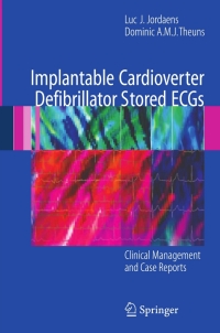 Titelbild: Implantable Cardioverter Defibrillator Stored ECGs 9781846286797