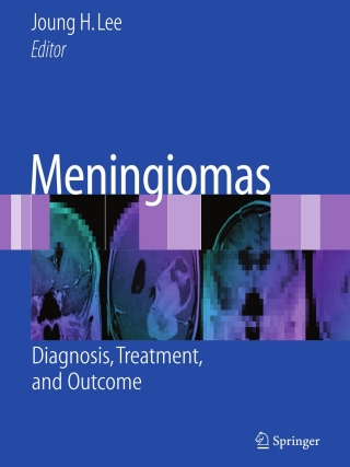 Cover image: Meningiomas 9781848829107
