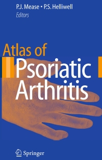 صورة الغلاف: Atlas of Psoriatic Arthritis 1st edition 9781846288968