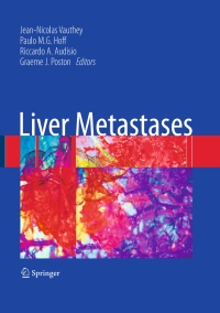 Cover image: Liver Metastases 9781846289460