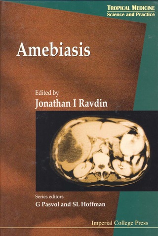 Cover image: Amebiasis 9781860941337