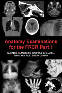 Immagine di copertina: Anatomy Examinations for the FRCR Part 1 4th edition 9781781662595