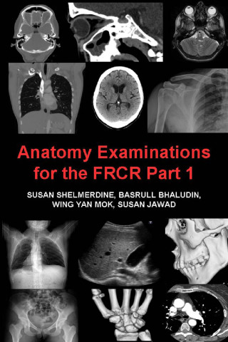Cover image: Anatomy Examinations for the FRCR Part 1 4th edition 9781849897167