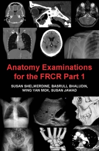 Cover image: Anatomy Examinations for the FRCR Part 1 4th edition 9781781662601