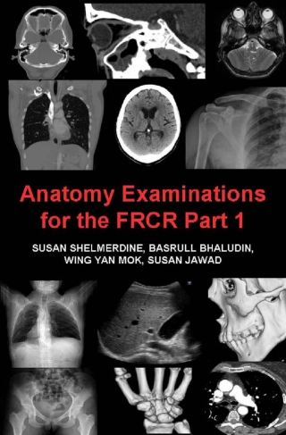 Imagen de portada: Anatomy Examinations for the FRCR Part 1 4th edition 9781849897174