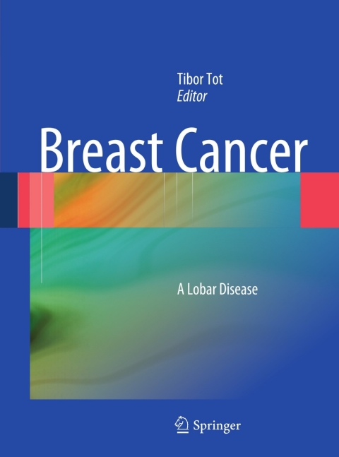 Breast Cancer : A Lobar Disease - FULL INSTANT DOWNLOAD | PDF DOCX EPUB