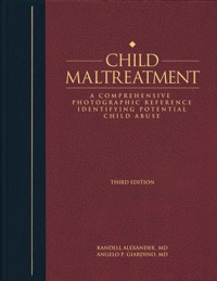 Omslagafbeelding: Child Maltreatment 3e, Volume 2 3rd edition 9781878060563