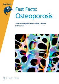 Cover image: Fast Facts: Osteoporosis 6th edition 9781905832514