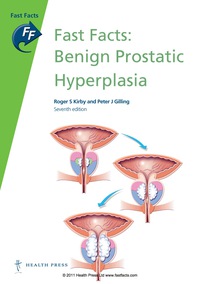 Titelbild: Fast Facts: Benign Prostatic Hyperplasia 7th edition 9781905832927