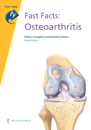 Imagen de portada: Fast Facts: Osteoarthritis 2nd edition 9781908541093
