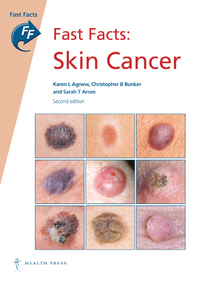 表紙画像: Fast Facts: Skin Cancer 2nd edition 9781908541390