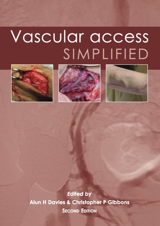 Cover image: Vascular Access Simplified; second edition 2nd edition 9781903378526