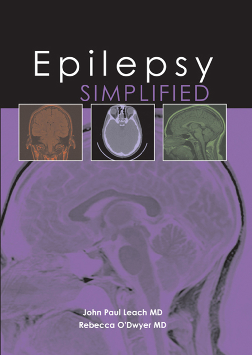 Epilepsy Simplified 1st Edition