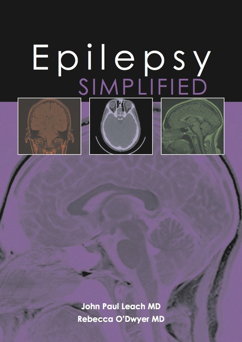 Epilepsy Simplified, 1st Edition - FULL INSTANT DOWNLOAD | PDF DOCX EPUB
