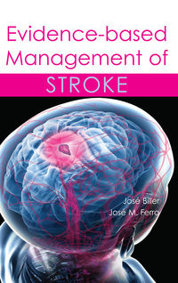 Cover image: Evidence-based Management of Stroke 1st edition 9781903378762