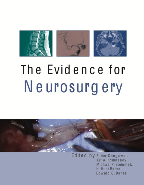 The Evidence for Neurosurgery, 1st Edition - FULL INSTANT DOWNLOAD | PDF DOCX EPUB