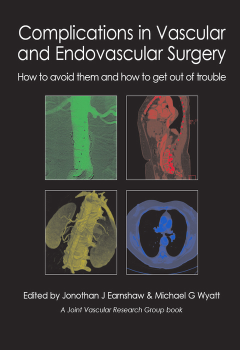 Complications in Vascular and Endovascular Surgery, 1st Edition - FULL INSTANT DOWNLOAD | PDF DOCX EPUB