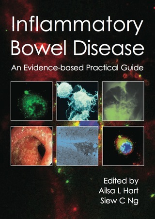 Cover image: Inflammatory Bowel Disease 1st edition 9781903378823