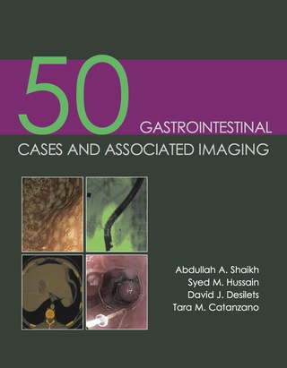 Cover image: 50 Gastrointestinal Cases and Associated Imaging 1st edition 9781903378854