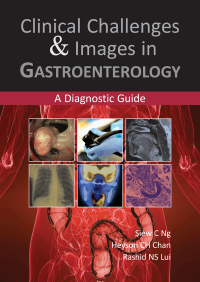 Cover image: Clinical Challenges & Images in Gastroenterology 1st edition 9781910079034