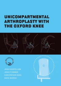Imagen de portada: Unicompartmental Arthroplasty with the Oxford Knee 2nd edition 9781910158456