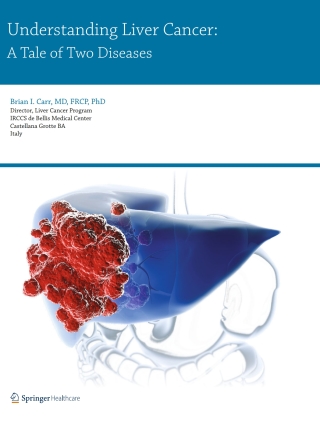 Cover image: Understanding Liver Cancer 9781910315019