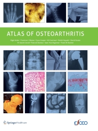 Cover image: Atlas of Osteoarthritis 9781910315156