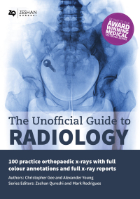 Titelbild: The Unofficial Guide to Radiology 1st edition 9781910399026