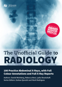 صورة الغلاف: Unofficial Guide to Radiology: 100 Practice Abdominal X-Rays 1st edition