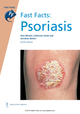 Cover image: Fast Facts: Psoriasis 4th edition 9781908541741