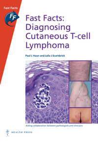 Omslagafbeelding: Fast Facts: Diagnosing Cutaneous T-cell Lymphoma 1st edition 9781910797204