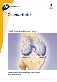 表紙画像: Fast Facts: Osteoarthritis 3rd edition
