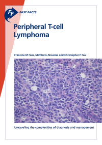 表紙画像: Fast Facts: Peripheral T-cell Lymphoma 9781912776184