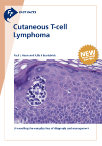 صورة الغلاف: Fast Facts: Cutaneous T-cell Lymphoma 9781912776306