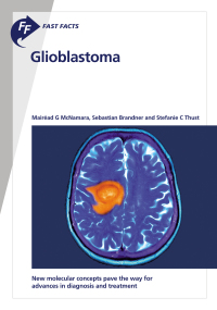 Cover image: Fast Facts: Glioblastoma 9781912776702