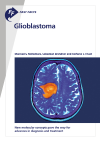 صورة الغلاف: Fast Facts: Glioblastoma 9781912776702