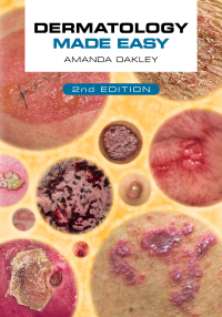 Cover image: Dermatology Made Easy, second edition 2nd edition 9781914961168
