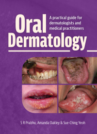 Imagen de portada: Oral Dermatology 9781914961410