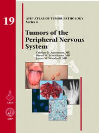 Imagen de portada: Tumors of the Peripheral Nervous System 4th edition 9781933477305