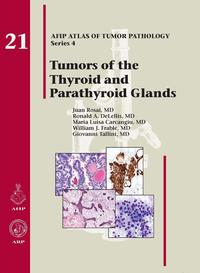 表紙画像: Tumors of the Thyroid and Parathyroid Glands 4th edition 9781933477329
