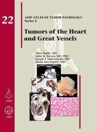 Imagen de portada: Tumors of the Heart and Great Vessels 4th edition 9781933477336