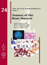 表紙画像: Tumors of the Bone Marrow 4th edition 9781933477350