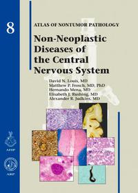 Cover image: Non-Neoplastic Diseases of the Central Nervous System 1st edition 9781933477084