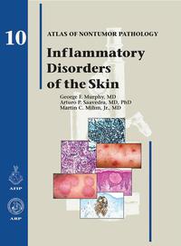 Cover image: Inflammatory Disorders of the Skin 1st edition 9781933477244