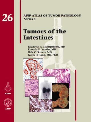 Cover image: Tumors of the Intestines 4th edition 9781933477398