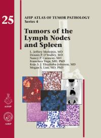 Cover image: Tumors of the Lymph, Node and Spleen 4th edition 9781933477381