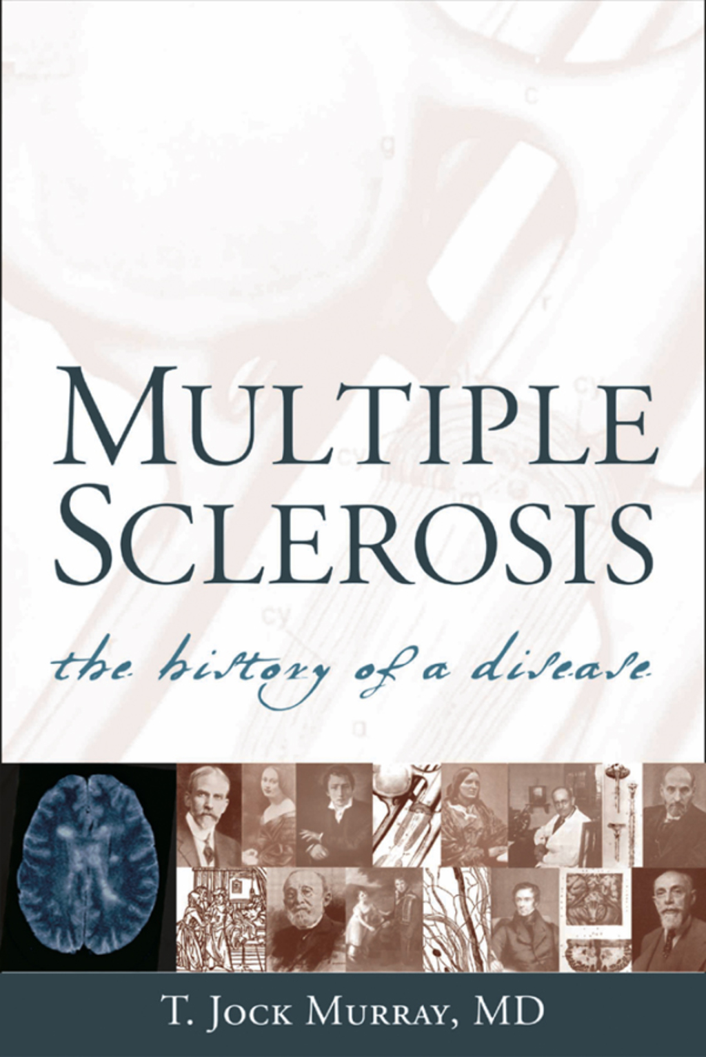 Multiple Sclerosis The History of a Disease 1st Edition