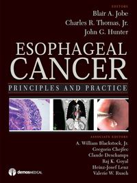 Cover image: Esophageal Cancer 1st edition 9781933864174